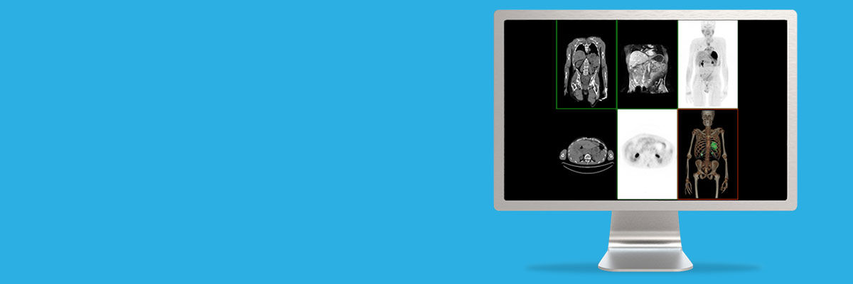 notcloneadvancedvisualizationapplicationsvolumeviewerawspotlightvolumeviewer