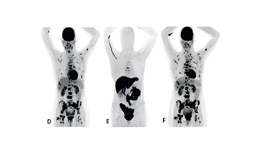 nuclear-imaging-agents-FeatureCardHalf_1-ci-en