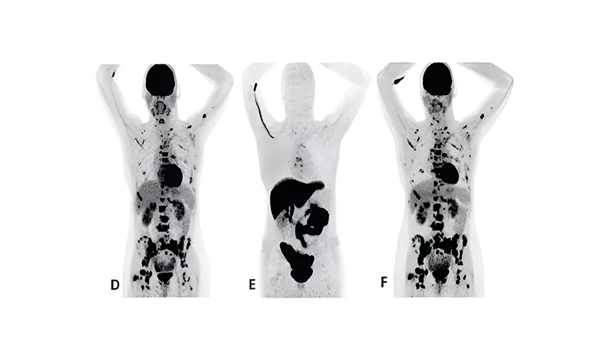 nuclear-imaging-agents-FeatureCardHalf_1-ci-en