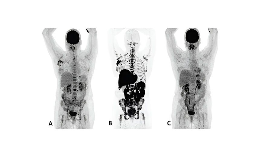 nuclear-imaging-agents-FeatureCardHalf_2-ci-en_