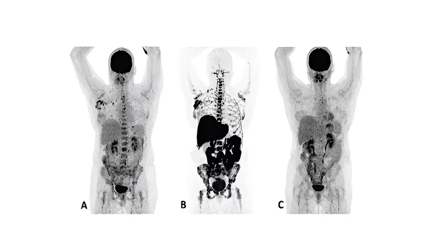 nuclear-imaging-agents-FeatureCardHalf_2-ci-en_