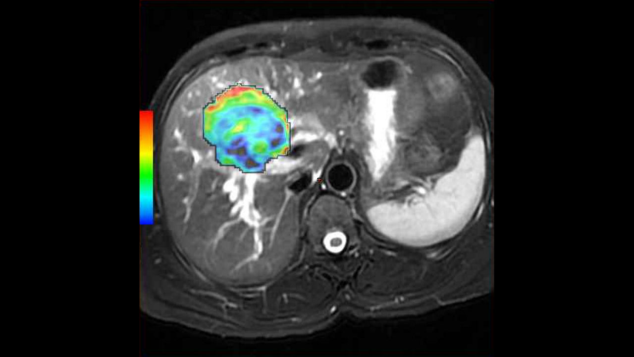 o-not-clone-advanced-visualization-applications-bodyview-aw-bodyview-clinical-images-1