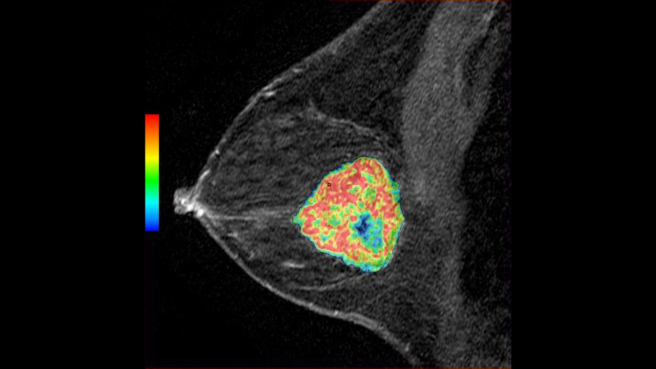 o-not-clone-advanced-visualization-applications-bodyview-aw-bodyview-clinical-images-2