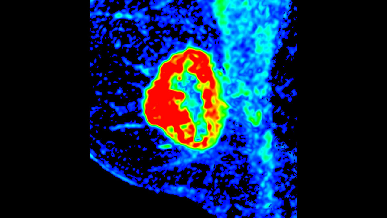 o-not-clone-advanced-visualization-applications-bodyview-aw-bodyview-clinical-images-3