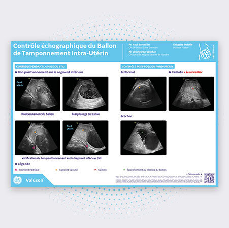 obstetri_img-2_2