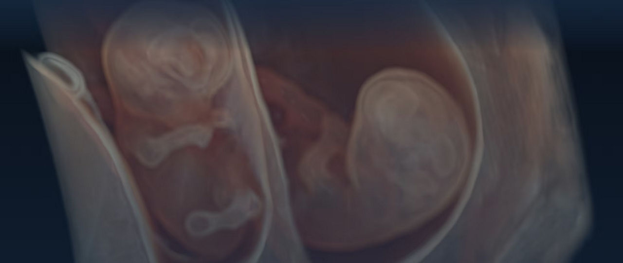 obstetrics-and-gynecology-sotry-imaging-solutions-ci-en