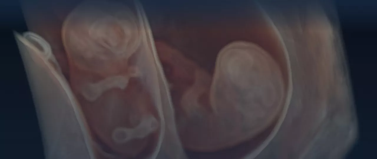obstetrics-and-gynecology-sotry-imaging-solutions-ci-en