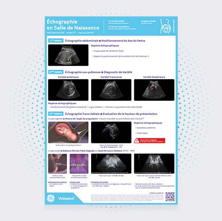 Obstetrique-echographie-salle-naissance-1