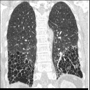oduct-categories-computed-tomography-revolution ct-image gallery-bottom left image new.png