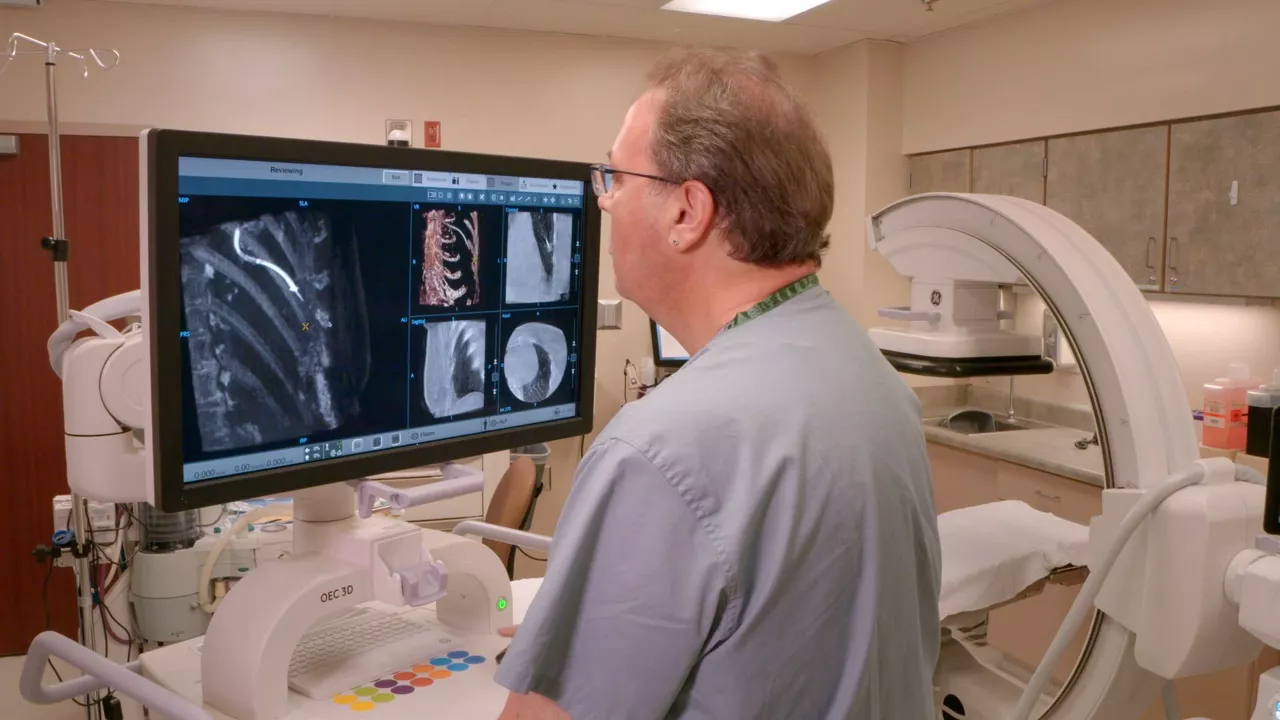 oec-3d-mobile-cbct-for-interventional-pulmonology
