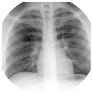 OEC Elite CFD 31 cm Chest