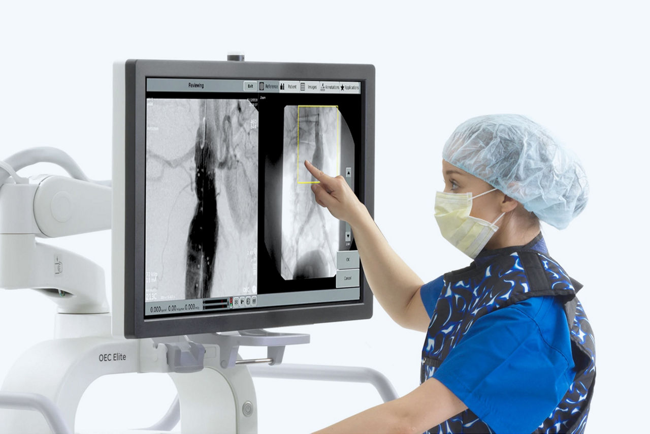 oec-elite-cfd-exceptional-images-ci-en