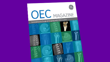 oec-c-arm-magazine-3