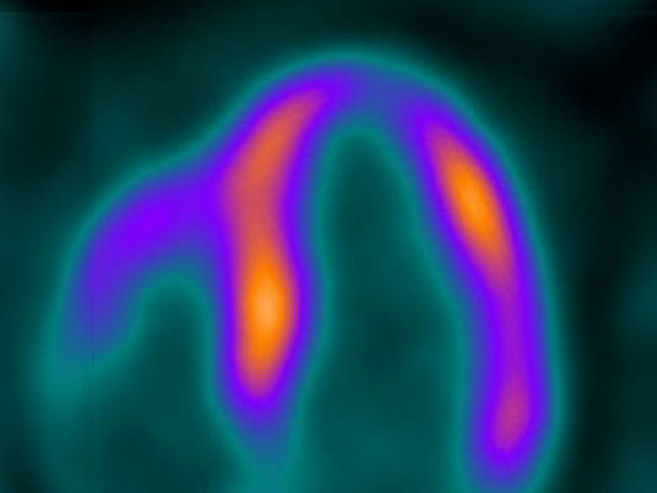 omni-legend-S_curve-ba-en