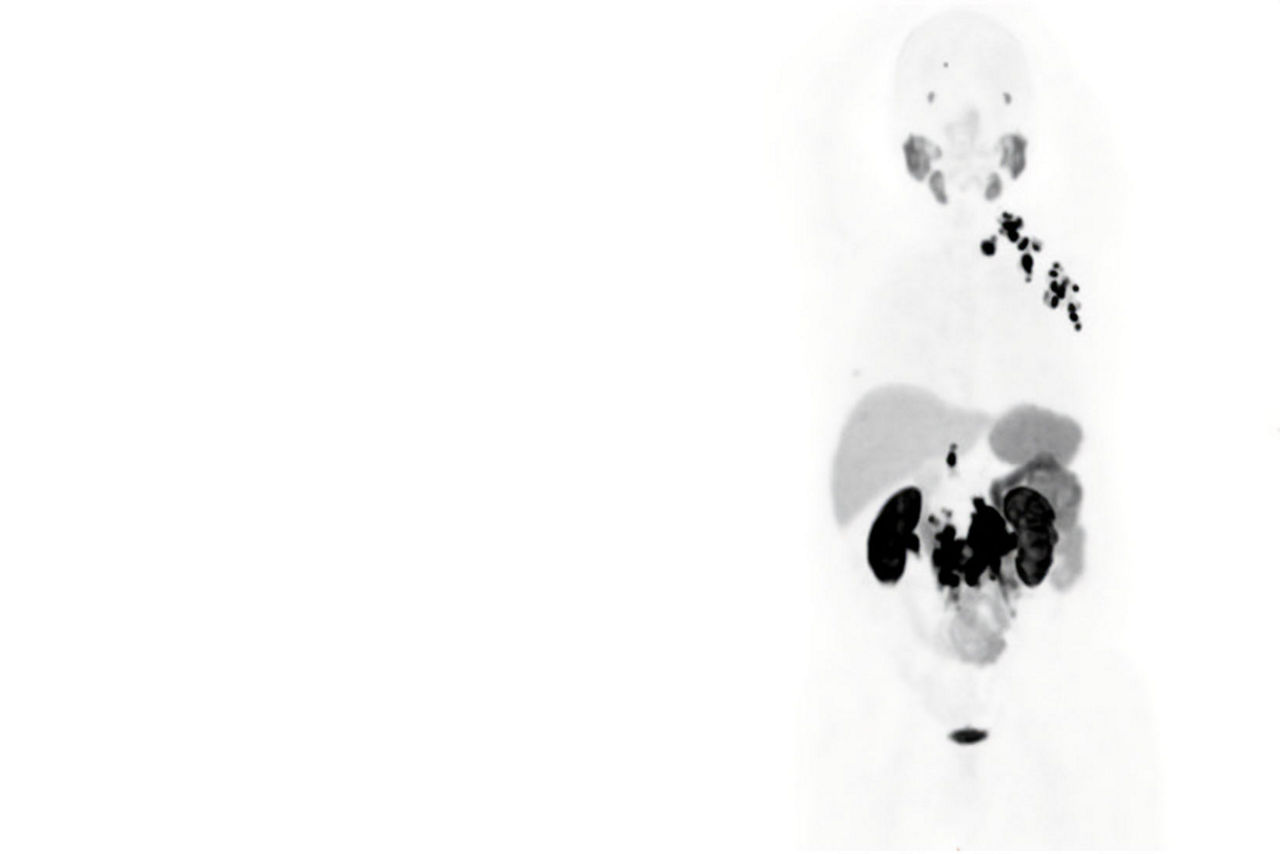 omni-legend-hero-sticky-scrolling-ba-en