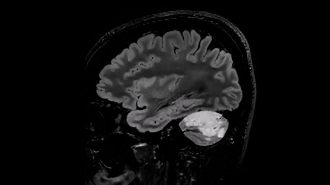 Onco-MRI-product-switcher-desktop