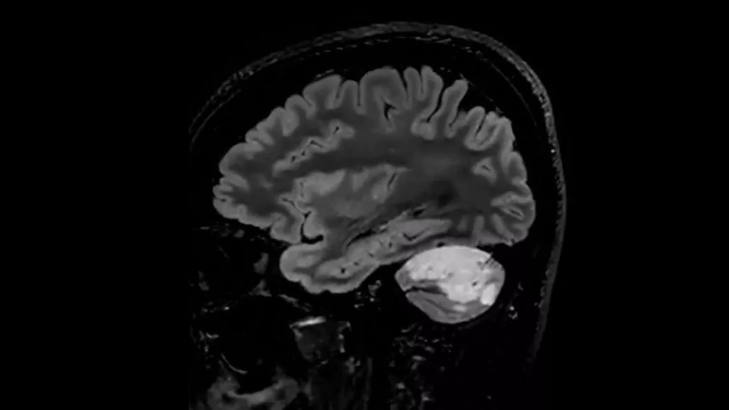 Onco-MRI-product-switcher-desktop