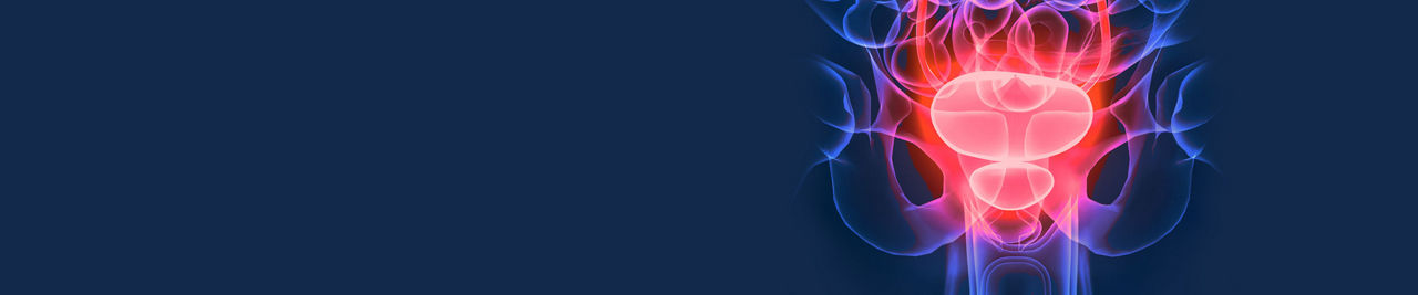 Prostate Cancer