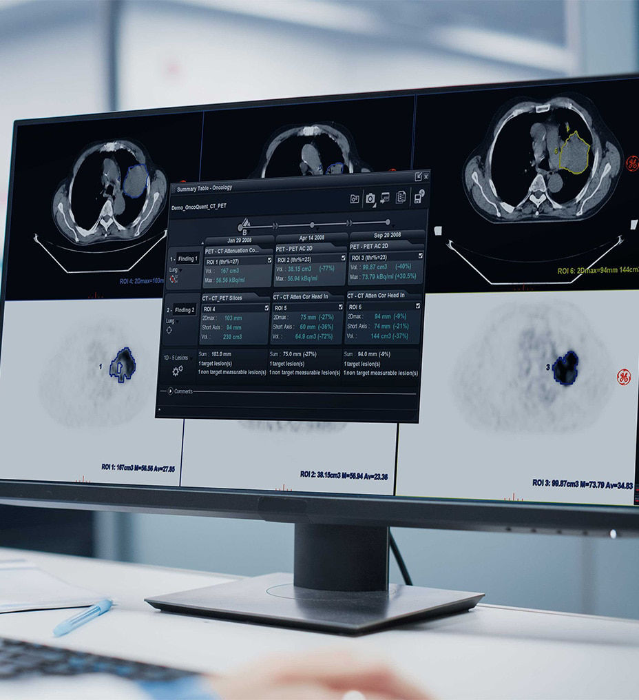 oncoquest-datamanagement-ba-en