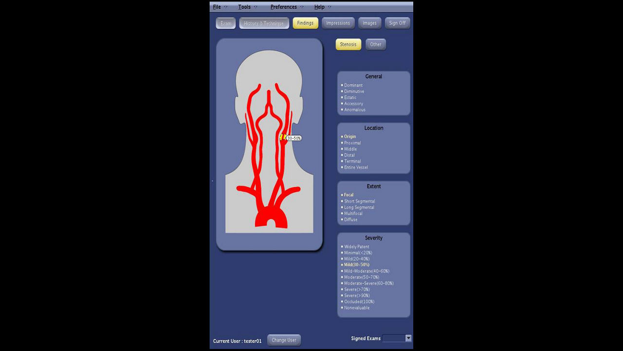 one-advanced-visualization-applications-angiocard-image-gallery-aw-angiocard-clinical1