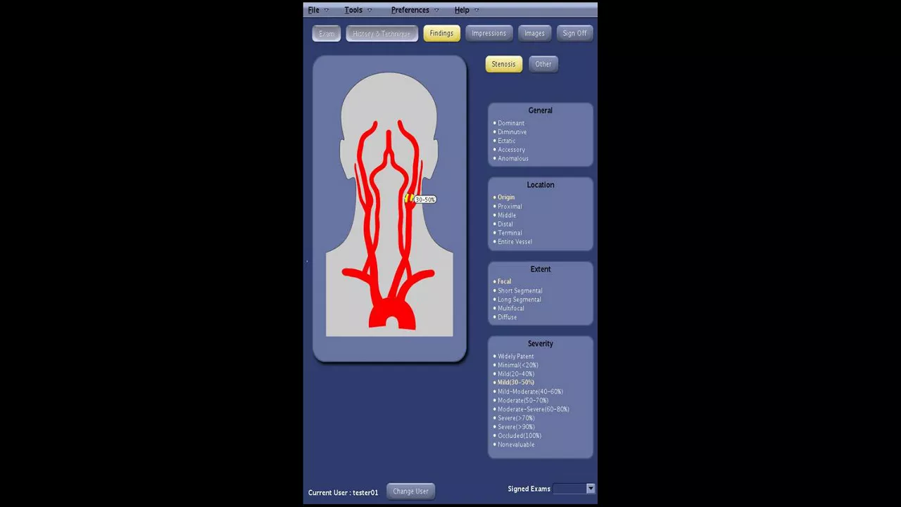 one-advanced-visualization-applications-angiocard-image-gallery-aw-angiocard-clinical1