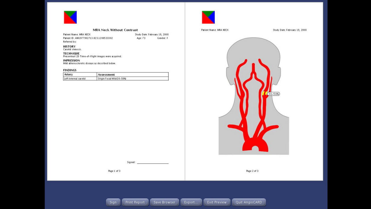 one-advanced-visualization-applications-angiocard-image-gallery-aw-angiocard-clinical2