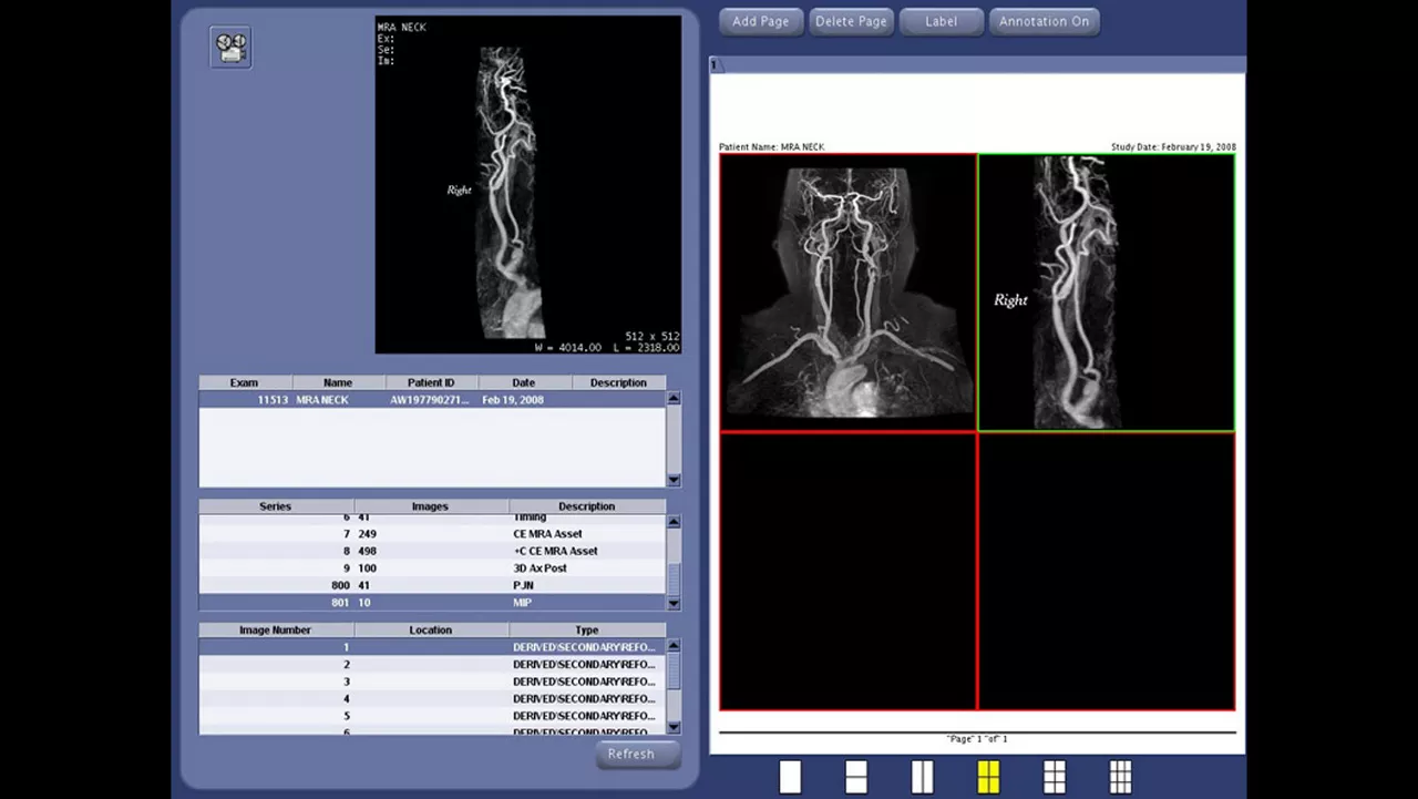 one-advanced-visualization-applications-angiocard-image-gallery-aw-angiocard-clinical4