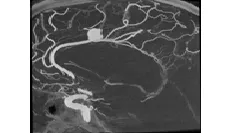 one-advanced-visualization-applications-innova-ct-hd-clinical-ge-awinnovacthd-se001