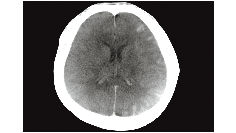one-advanced-visualization-applications-innova-ct-hd-clinical-ge-awinnovacthd-se003