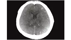 one-advanced-visualization-applications-innova-ct-hd-clinical-ge-awinnovacthd-se003