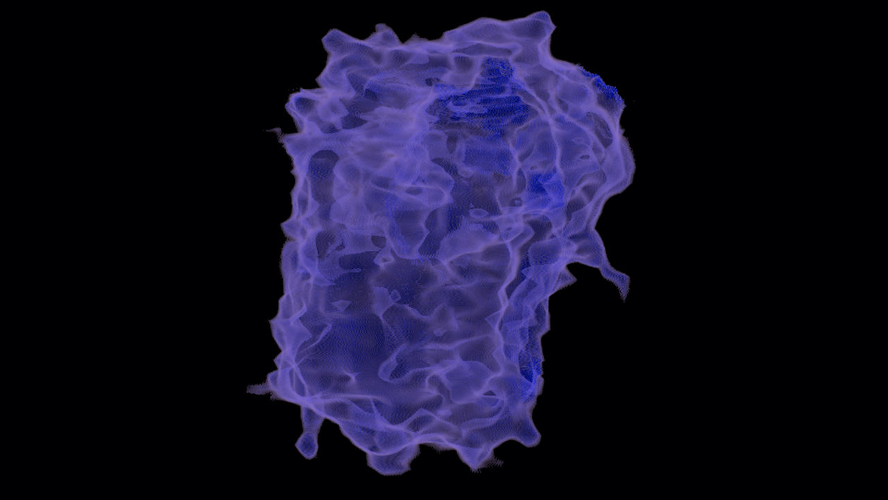 one-advanced-visualization-applications-lung-vcar-image-gallery-aw-lung-vcar-clinical3
