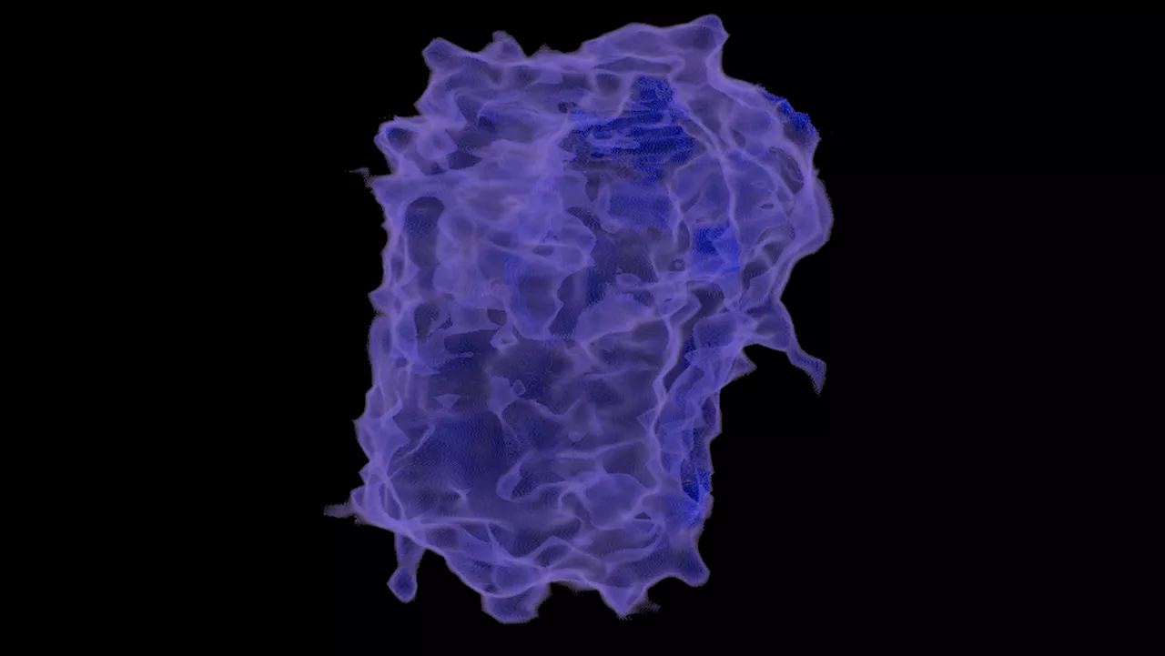one-advanced-visualization-applications-lung-vcar-image-gallery-aw-lung-vcar-clinical3