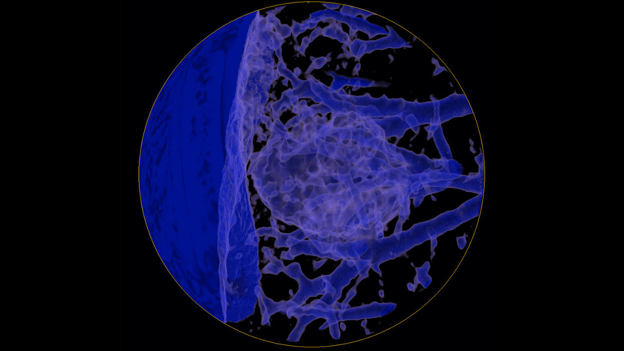 one-advanced-visualization-applications-lung-vcar-image-gallery-aw-lung-vcar-clinical4