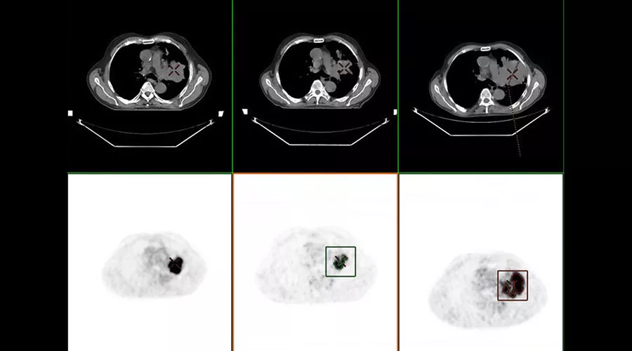 one-advanced-visualization-applications-oncoquant-image-gallery-aw-oncoquant-clinical5
