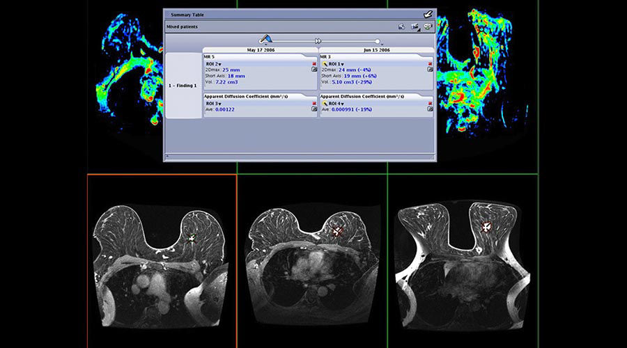 one-advanced-visualization-applications-oncoquant-image-gallery-aw-oncoquant-clinical6