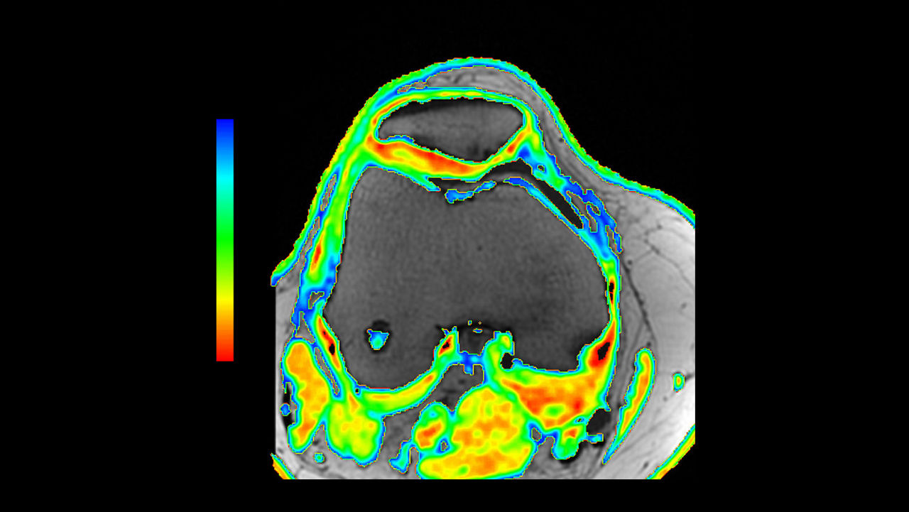 one-advanced-visualization-applications-readyview-aw-readyview-clinical-image-t2mapv1