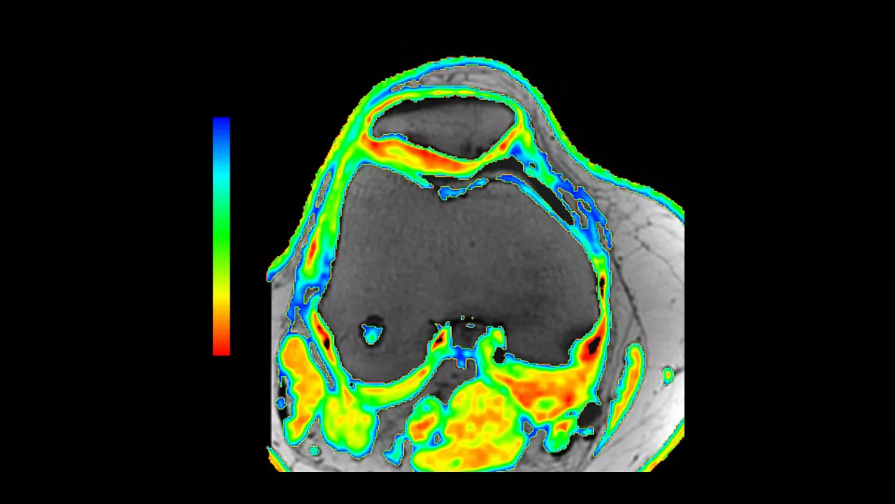 one-advanced-visualization-applications-readyview-aw-readyview-clinical-image-t2mapv1