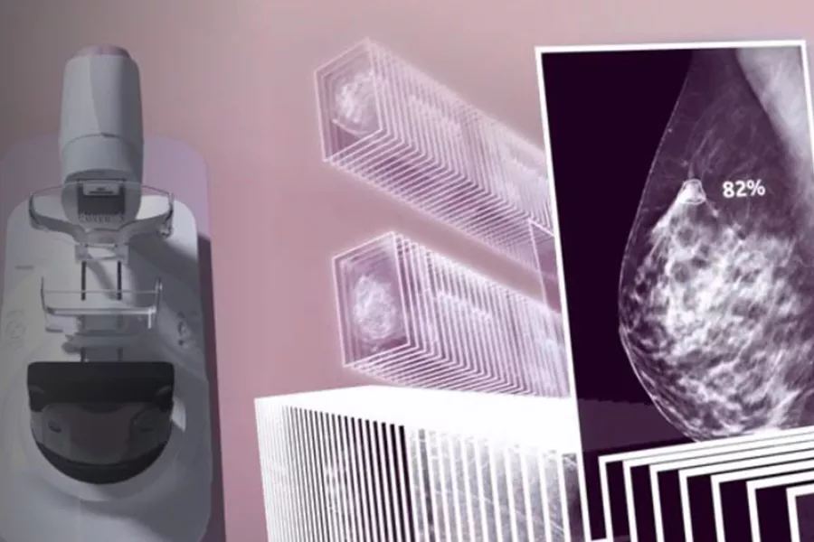 ProFound AI™ by iCAD for Senographe Pristina™