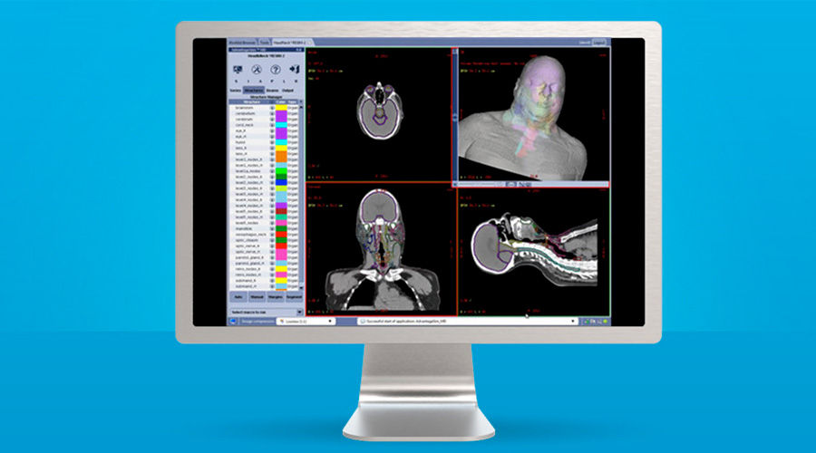 ons-advantagesim-md-gehc-advantagesim-md-spotlight-ct-atlas-segmentation-head-and-neck