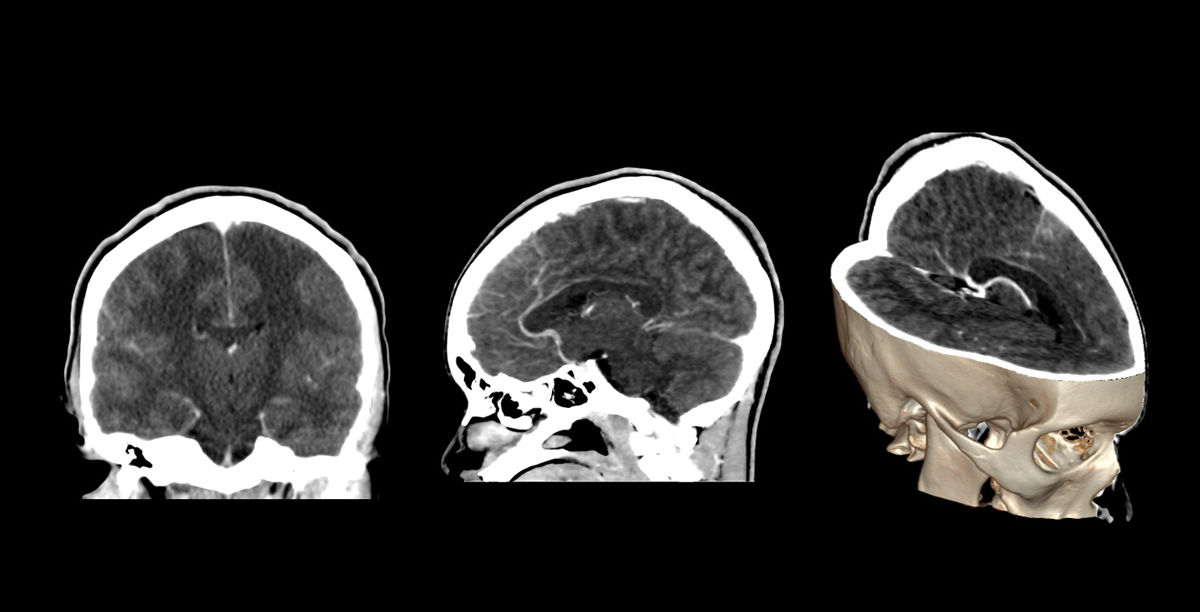 OptimaCT-CG-Neuro03