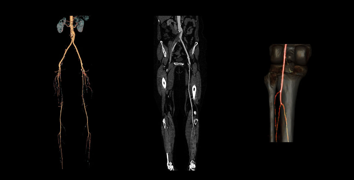 OptimaCT-CG-Vascular01