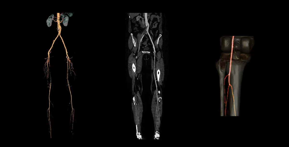 OptimaCT-CG-Vascular01