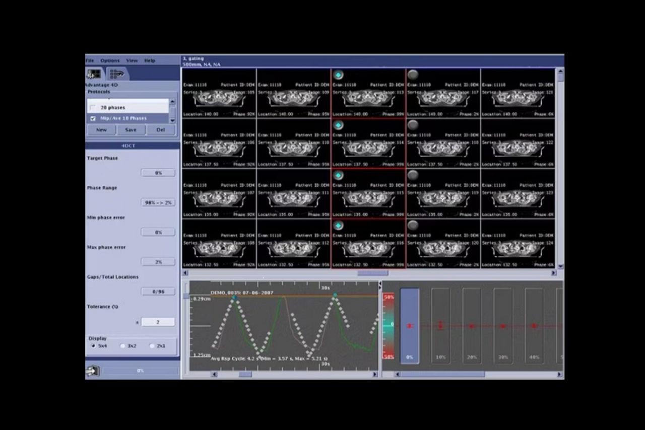 optimize-patient-ci-en