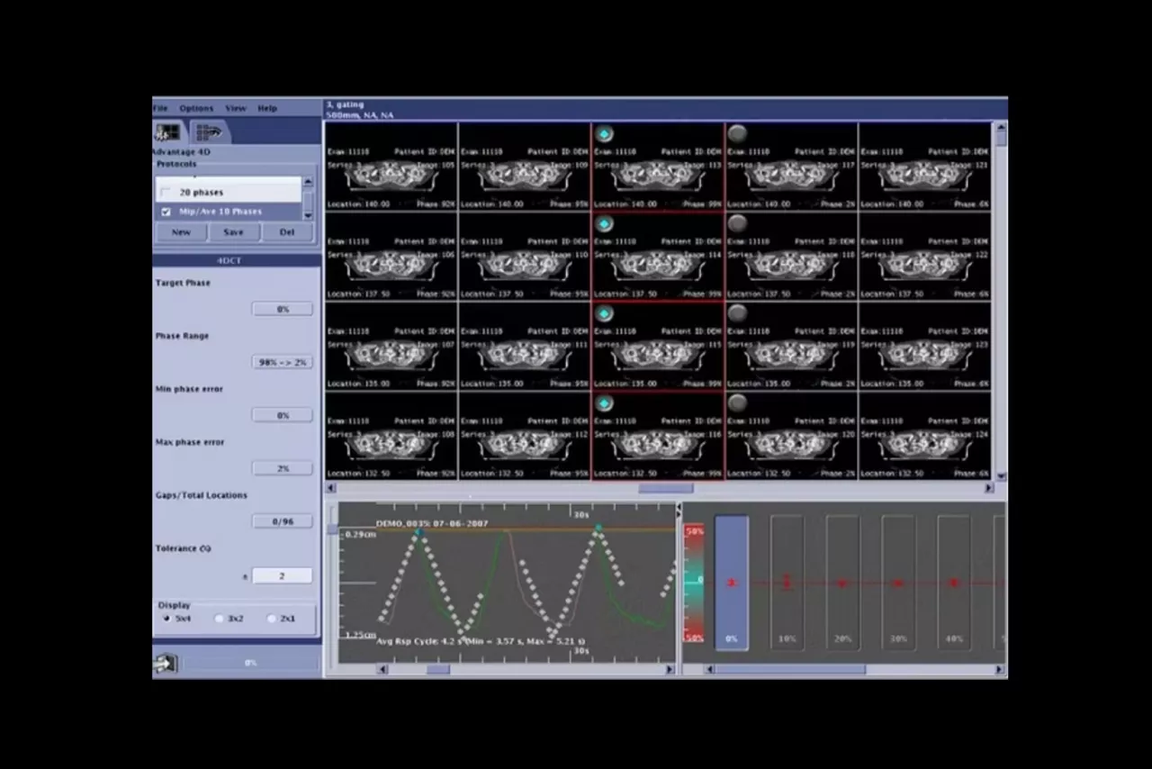 optimize-patient-ci-en