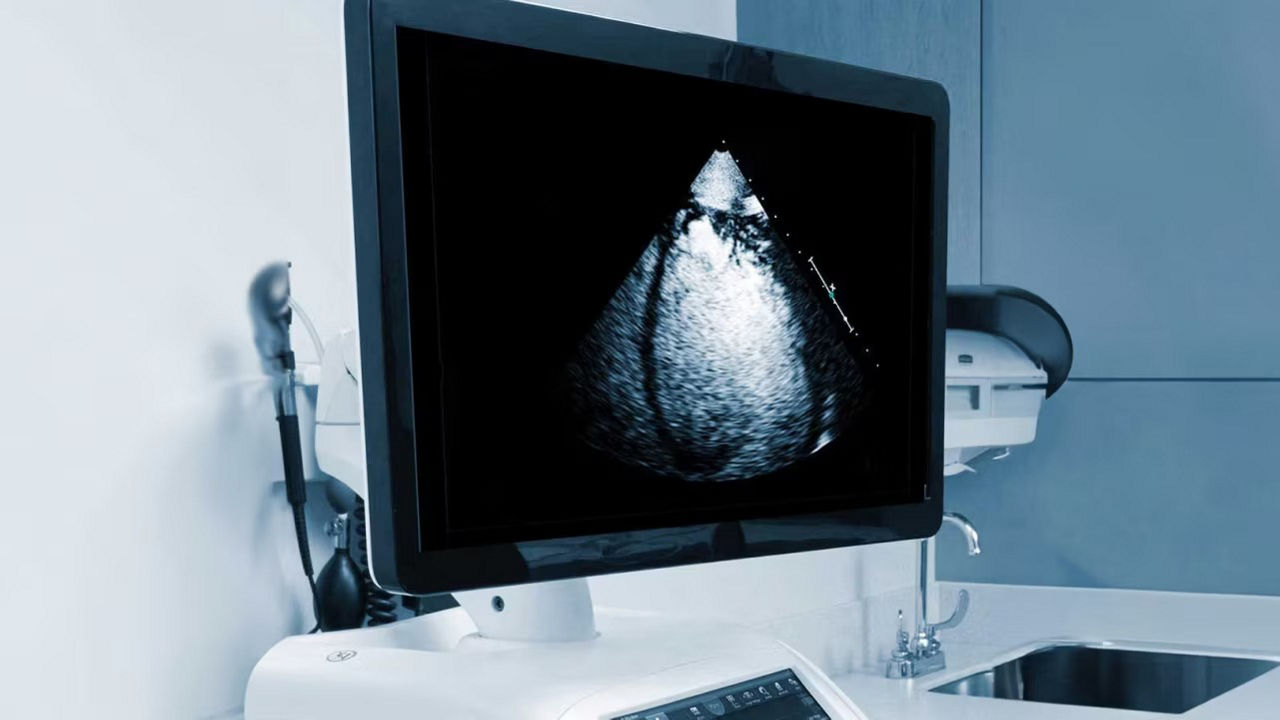 optison-abundant-plasme-ci-en