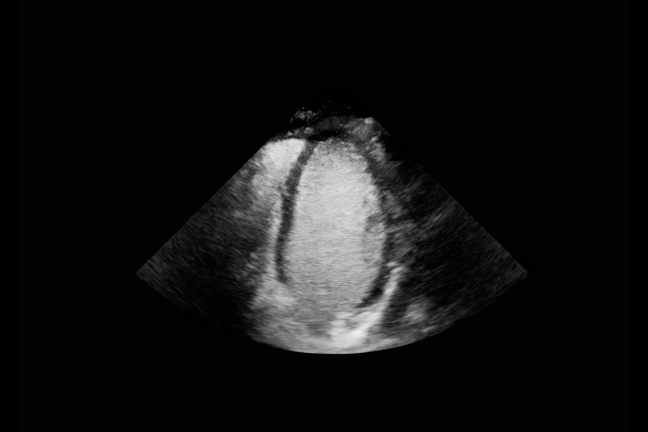 optison-image-quality-hero-ba-en