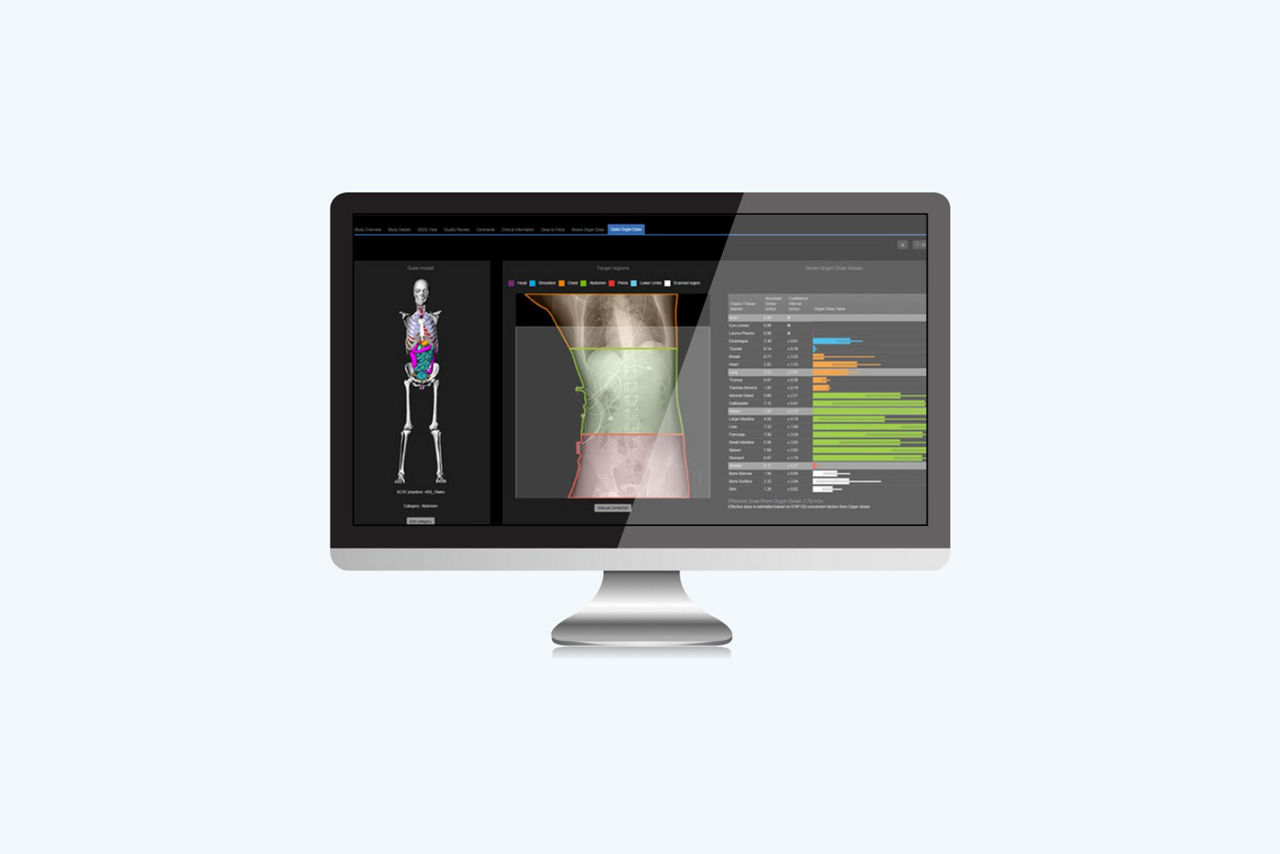 organ-dose-dosimetry
