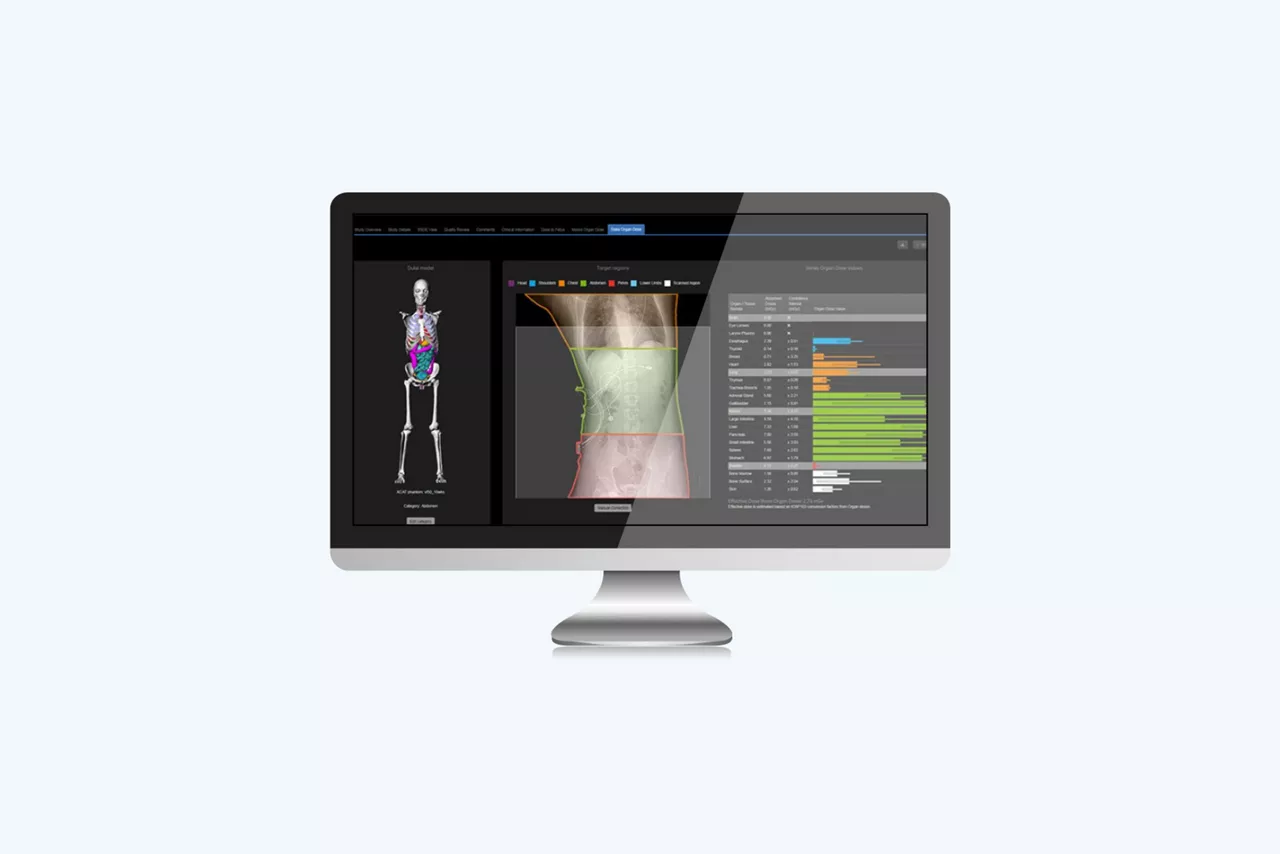 organ-dose-dosimetry