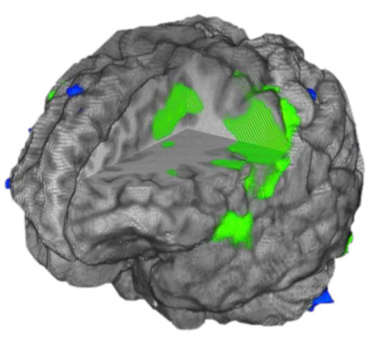ories-do-not-clone-advanced-visualization-applications-brainwave-aw-brainwave_overview