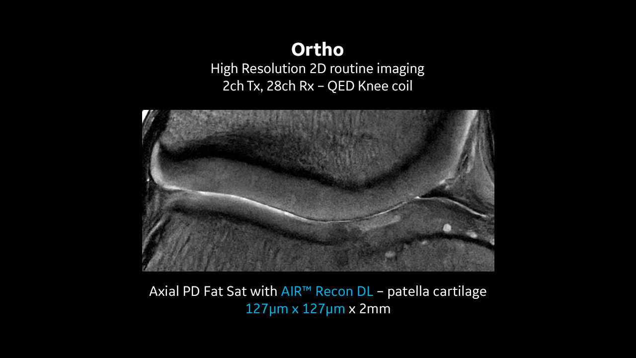 SIGNA™ 7T MRI scanner clinical images | GE HealthCare (Australia